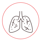 Lung cencer